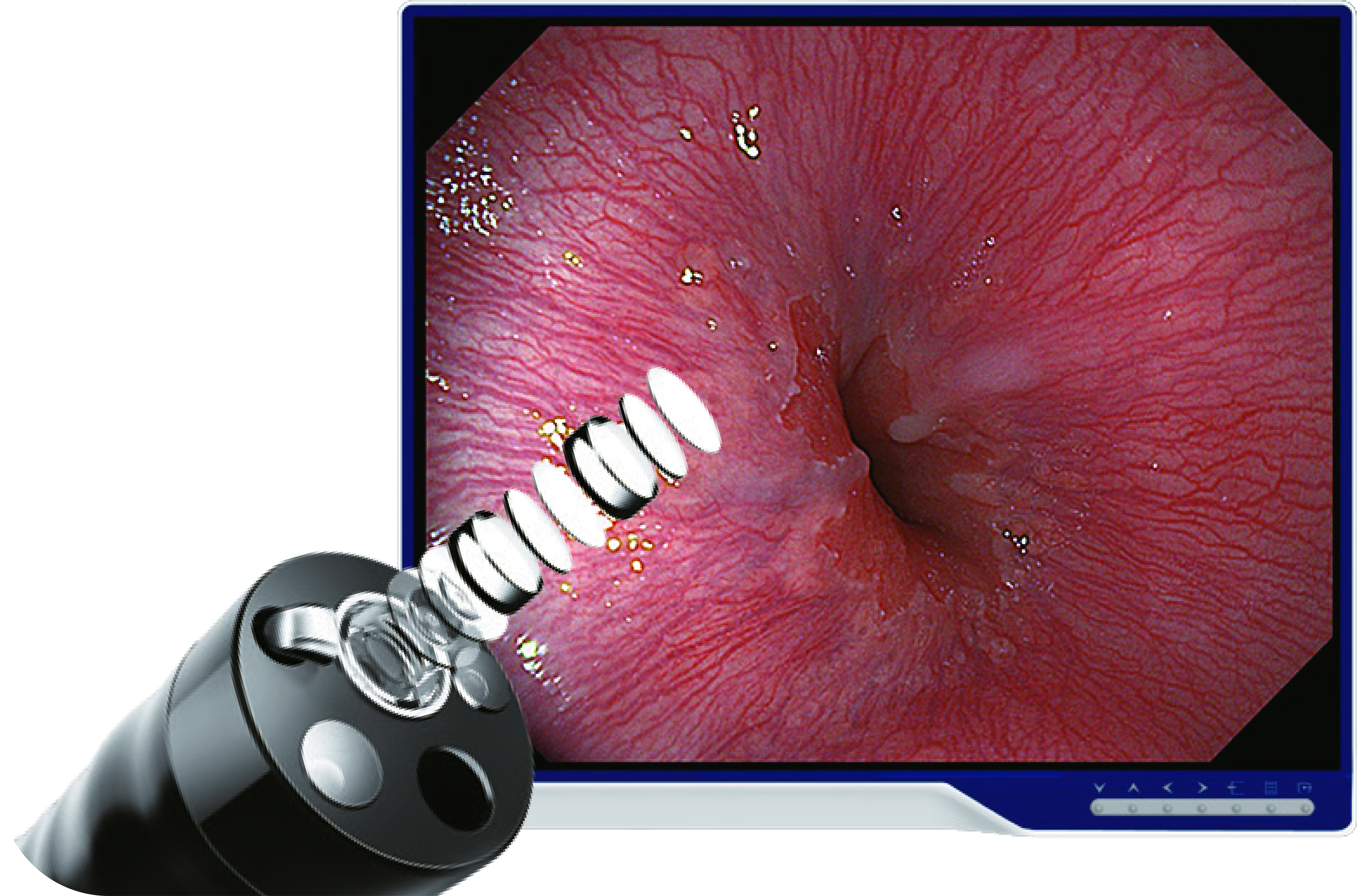 Видеогастроскоп Aohua FHD-GT200J фото7