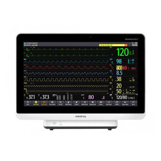 Монитор пациента Mindray BeneVision N17 : фотографии