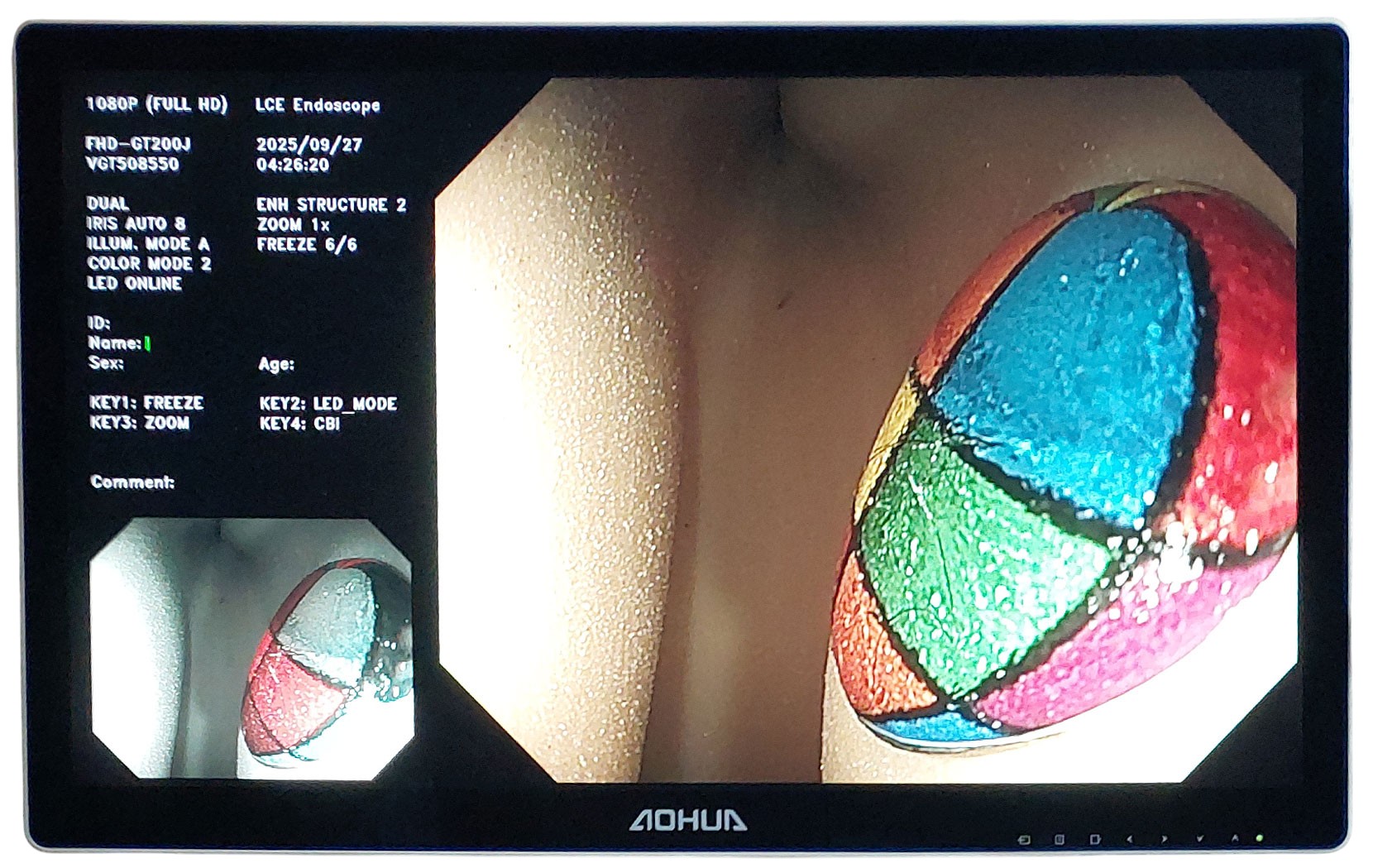 Видеоэндоскопическая система Aohua AQ-200 фото8