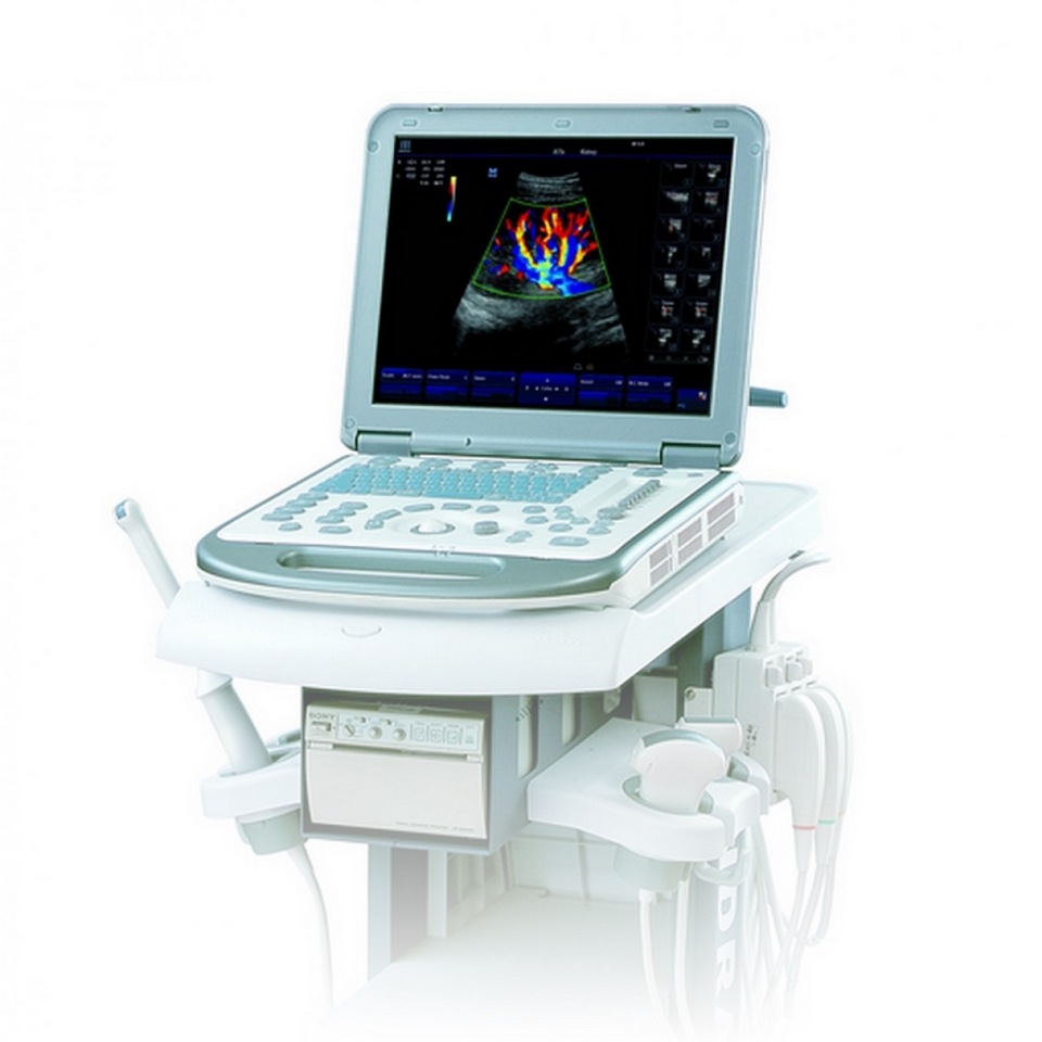 Аппарат ультразвукой диагностики Mindray M5 фото2