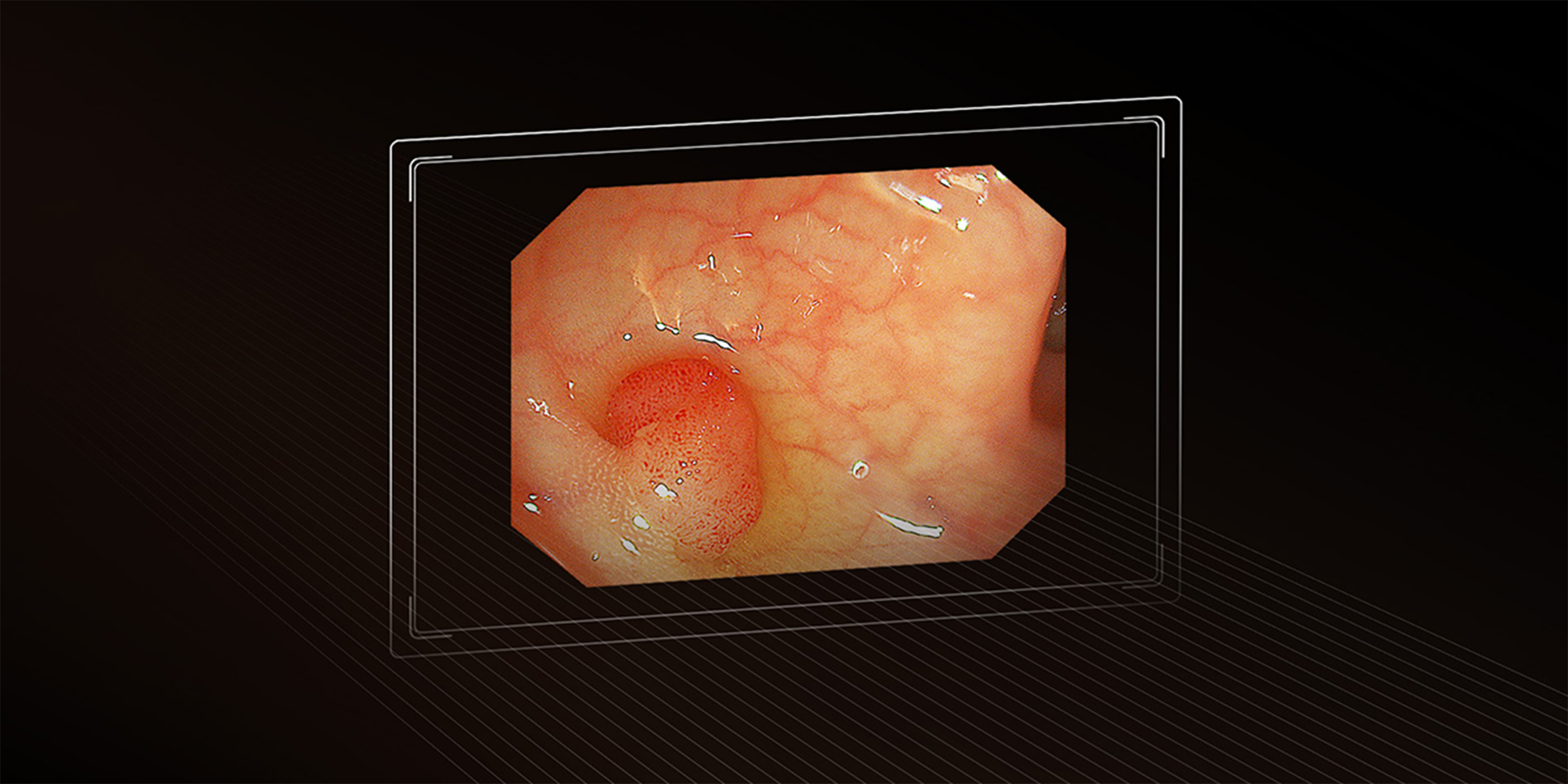 Видеогастроскоп Aohua VGT-Q30J фото6